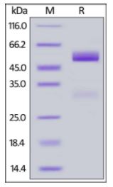 Human Frizzled-5, Fc Tag on SDS-PAGE under reducing (R) condition. The gel was stained overnight with Coomassie Blue. The purity of the protein is greater than 95%.